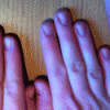 Hvor lang er tolvfingertarmen? © Erik Back 2012